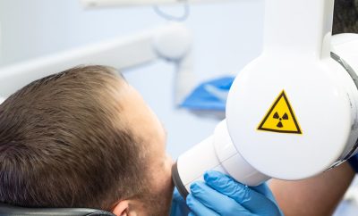 Kanalų pergydymas: kodėl kartais reikia gydyti jau gydytą dantį?