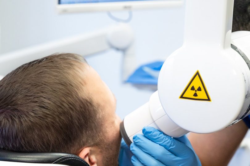 Kanalų pergydymas: kodėl kartais reikia gydyti jau gydytą dantį?